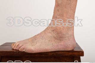 Photo reference of foot 0004